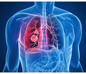 Медикаментозное управление окислительно-восстановительным состоянием организма  при заболеваниях органов дыхания  (часть 4)