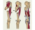 Варіанти оптимізації медичної та соціальної адаптації геронтологічних хворих із переломами проксимального відділу стегнової кістки