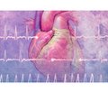 Обзор рекомендаций AHA/ACC/HRS по ведению пациентов с желудочковой аритмией и профилактике внезапной сердечной смерти — 2017. Часть 2