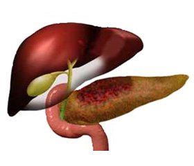 Ультразвуковые аспекты в диагностике осложненных форм острого панкреатита