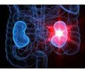 Kidney damage in some rheumatic diseases