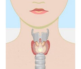 Коментарі до клінічних рекомендацій 2018 року Європейської тиреоїдної асоціації щодо аміодарон-асоційованої дисфункції щитоподібної залози