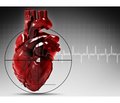 Стан систолічної функції та діастолічного наповнення міокарда у хворих з інфарктом міокарда правого шлуночка на фоні Q-інфаркту міокарда лівого шлуночка протягом 6 місяців спостереження