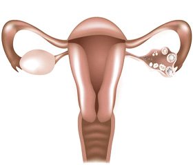 Профиль личности женщин позднего репродуктивного и пременопаузального возраста с патологией эндометрия