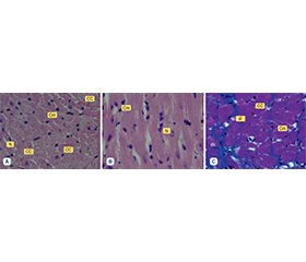 Експериментальний аналіз ремоделювання міокарда під впливом комбінованого метаболічного i гемодинамічного стресу та його фармакологічна корекція