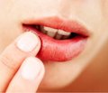 Диагностика и лечение аллергических заболеваний губ