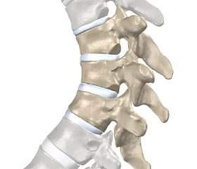 Evaluation of the musculoskeletal system functional state in patients with different variants of the Scheuermann’s disease