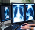 Коли потрібен панорамний рентгенологічний знімок?