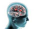 Симптоми і стадії розвитку хронічної ішемії головного мозку (частина 1)