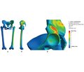 Дослідження впливу чашок ендопротезів кульшових суглобів із пористого титану на розподіл напружень у кістковій тканині (математичне моделювання)