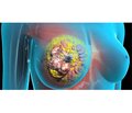 РІ3К-шлях клітинної регуляції при раку молочної залози: патофізіологія та значення в лікуванні