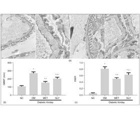 Ренопротекторний ефект метформіну в щурів із цукровим діабетом 2-го типу реалізується шляхом посилення експресії фактора пігментного епітелію в тканині нирок