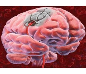 Neuroprotection in acute ischemic stroke: from neuropharmacology to pharmacotherapy