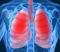 Влияние сопутствующей гастроэзофагеальной рефлюксной болезни на клиническое течение и функцию внешнего дыхания у больных хроническим обструктивным заболеванием легких