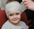 Особенности ближайших исходов лечения детей с ушибом головного мозга легкой степени