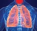 Риски и польза от применения антибиотиков при инфекциях дыхательных путей